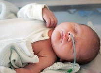 Bebeklerde Safra Kesesi Taşı Tedavisi Bebeklerde Safra Kesesi Taşı Tedavisi